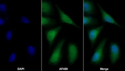 Invitrogen COMT Polyclonal Antibody:Antibodies:Primary Antibodies