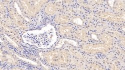 Invitrogen COMT Polyclonal Antibody:Antibodies:Primary Antibodies