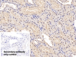 Invitrogen COMT Polyclonal Antibody:Antibodies:Primary Antibodies