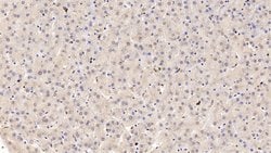 Invitrogen COMT Polyclonal Antibody:Antibodies:Primary Antibodies
