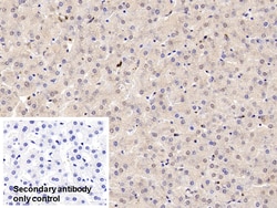 Invitrogen COMT Polyclonal Antibody:Antibodies:Primary Antibodies