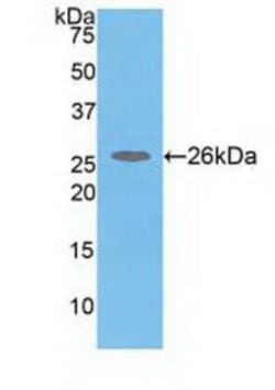 Invitrogen COMT Polyclonal Antibody:Antibodies:Primary Antibodies