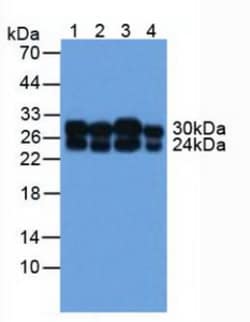 Invitrogen COMT Polyclonal Antibody:Antibodies:Primary Antibodies