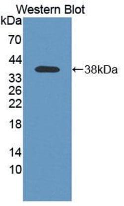 Invitrogen Cathepsin Z Polyclonal Antibody 20 &mu;L; Unconjugated:Antibodies,