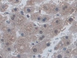 Invitrogen CD300c Polyclonal Antibody 200 &mu;L; Unconjugated:Antibodies,