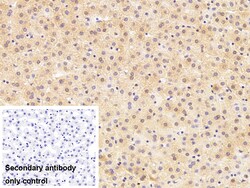 Invitrogen CD5 Polyclonal Antibody 20 &mu;L; Unconjugated:Antibodies, Polyclonal