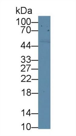 Invitrogen CD5 Polyclonal Antibody:Antibodies:Primary Antibodies