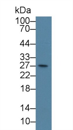 Invitrogen CENPH Polyclonal Antibody 200 &mu;L; Unconjugated:Antibodies,