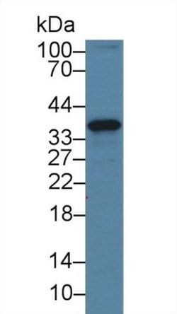 Invitrogen CENPH Polyclonal Antibody 200 &mu;L; Unconjugated:Antibodies,