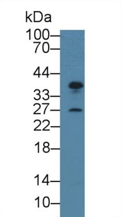 Invitrogen CENPH Polyclonal Antibody 200 &mu;L; Unconjugated:Antibodies,