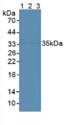 Invitrogen CENPH Polyclonal Antibody 200 &mu;L; Unconjugated:Antibodies,