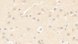 Invitrogen TCP-1 beta Polyclonal Antibody:Antibodies:Primary Antibodies