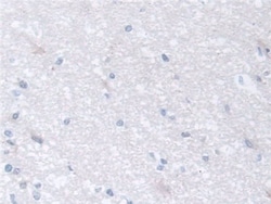 Invitrogen TCP-1 beta Polyclonal Antibody 200 &mu;L; Unconjugated:Antibodies,