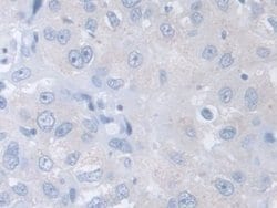 Invitrogen TCP-1 beta Polyclonal Antibody:Antibodies:Primary Antibodies