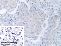 Invitrogen TCP-1 beta Polyclonal Antibody 200 &mu;L; Unconjugated:Antibodies,