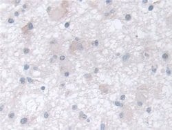 Invitrogen TCP-1 beta Polyclonal Antibody:Antibodies:Primary Antibodies