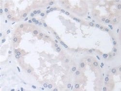 Invitrogen TCP-1 beta Polyclonal Antibody:Antibodies:Primary Antibodies