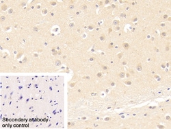 Invitrogen TCP-1 beta Polyclonal Antibody 200 &mu;L; Unconjugated:Antibodies,