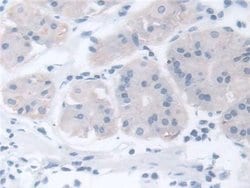 Invitrogen TCP-1 beta Polyclonal Antibody:Antibodies:Primary Antibodies