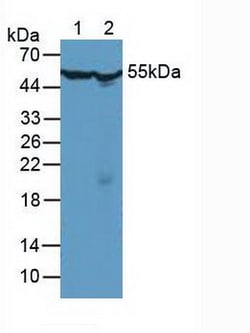 Invitrogen TCP-1 beta Polyclonal Antibody 200 &mu;L; Unconjugated:Antibodies,