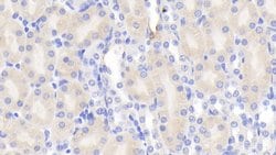 Invitrogen Chemerin Polyclonal Antibody:Antibodies:Primary Antibodies