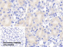 Invitrogen Chemerin Polyclonal Antibody:Antibodies:Primary Antibodies