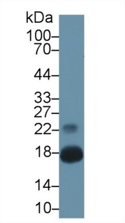 Invitrogen Chemerin Polyclonal Antibody:Antibodies:Primary Antibodies