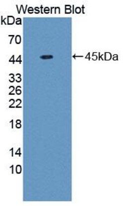 Invitrogen Chemerin Polyclonal Antibody:Antibodies:Primary Antibodies