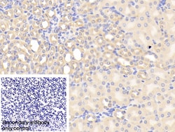 Invitrogen CHRDL1 Polyclonal Antibody:Antibodies:Primary Antibodies
