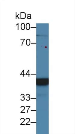 Invitrogen CHRDL1 Polyclonal Antibody:Antibodies:Primary Antibodies
