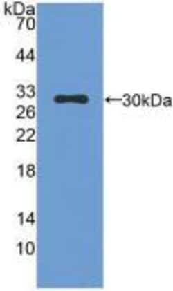 Invitrogen Mast Cell Chymase Polyclonal Antibody 20 &mu;L; Unconjugated:Antibodies,