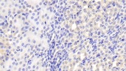 Invitrogen CLTA Polyclonal Antibody 200 &mu;L; Unconjugated:Antibodies,