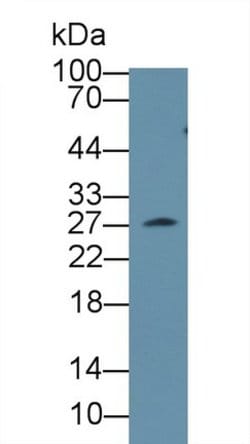 Invitrogen CLTA Polyclonal Antibody 200 &mu;L; Unconjugated:Antibodies,