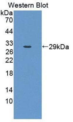 Invitrogen CLTA Polyclonal Antibody 200 &mu;L; Unconjugated:Antibodies,