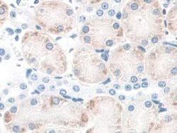 Invitrogen CD164 Polyclonal Antibody 200 &mu;L; Unconjugated:Antibodies,