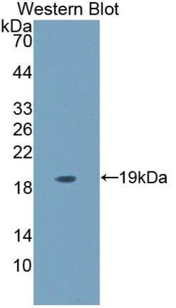 Invitrogen CD164 Polyclonal Antibody 200 &mu;L; Unconjugated:Antibodies,