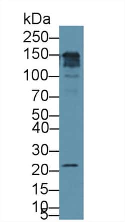 Invitrogen CD164 Polyclonal Antibody 200 &mu;L; Unconjugated:Antibodies,