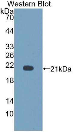 Invitrogen CD164 Polyclonal Antibody 20 &mu;L; Unconjugated:Antibodies,