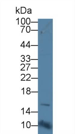Invitrogen CD164 Polyclonal Antibody 20 &mu;L; Unconjugated:Antibodies,