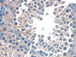 Invitrogen DC-SIGN Polyclonal Antibody 20 &mu;L; Unconjugated:Antibodies,