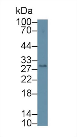 Invitrogen DC-SIGN Polyclonal Antibody 20 &mu;L; Unconjugated:Antibodies,