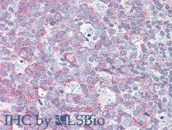 Invitrogen CD229 Polyclonal Antibody 20 &mu;L; Unconjugated:Antibodies,