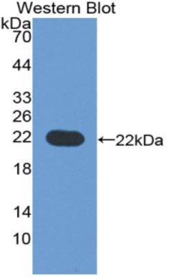 Invitrogen B7-H3 Polyclonal Antibody 200 &mu;L; Unconjugated:Antibodies,