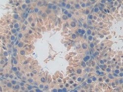 Invitrogen CD301 Polyclonal Antibody 200 &mu;L; Unconjugated:Antibodies,