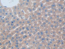 Invitrogen CD301 Polyclonal Antibody 200 &mu;L; Unconjugated:Antibodies,