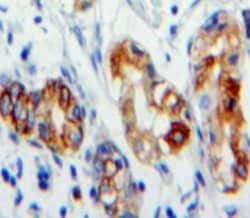 Invitrogen CD36 Polyclonal Antibody 200 &mu;L; Unconjugated:Antibodies,