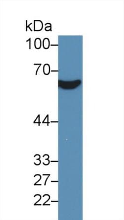 Invitrogen CD36 Polyclonal Antibody 200 &mu;L; Unconjugated:Antibodies,