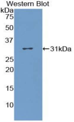 Invitrogen CD36 Polyclonal Antibody 200 &mu;L; Unconjugated:Antibodies,