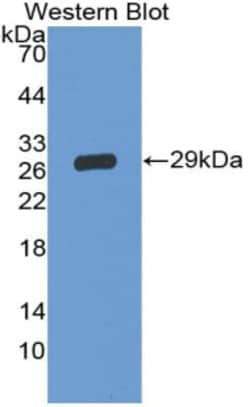 Invitrogen CD42d Polyclonal Antibody 20 &mu;L; Unconjugated:Antibodies,