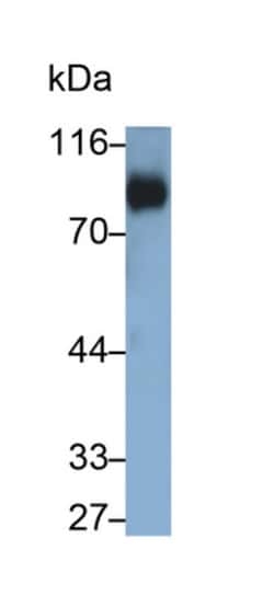 Invitrogen CD42d Polyclonal Antibody 200 &mu;L | Buy Online | Invitrogen&trade; | Fisher Scientific